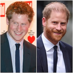 Prince Harry appears to be smiling in a 2010 photo, in which he has noticeably more hair than in a 2026 photo.