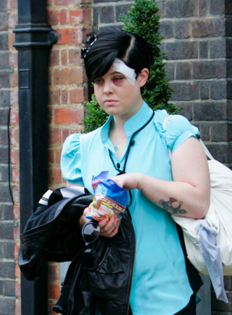 galleries/2012/06/13/stars-with-shiners-lady-gaga-reese-witherspoon-robert-downey-jr-madonna-others/osbourne-stars-with-shiners_ud6hhu