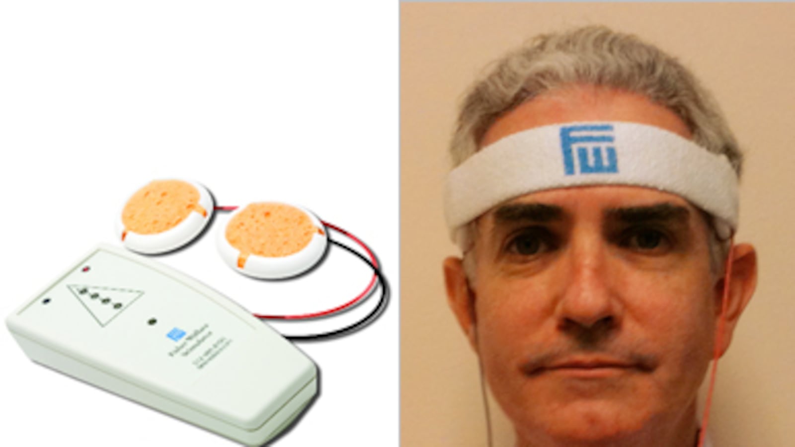 articles/2010/11/30/fisher-wallace-stimulator-behind-the-do-it-yourself-shock-therapy/schwartz-electro-therapy_144210_npudps