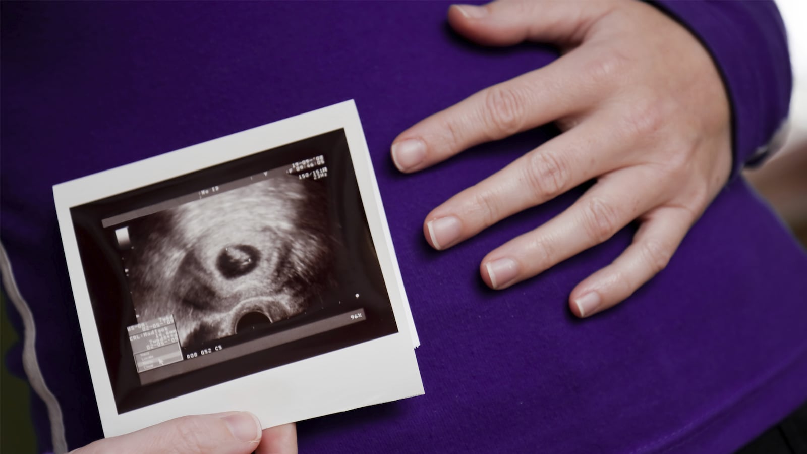 articles/2015/01/29/parents-sue-over-wrongful-abortion/150128-zadrozny-abortion-tease_rcyhxf