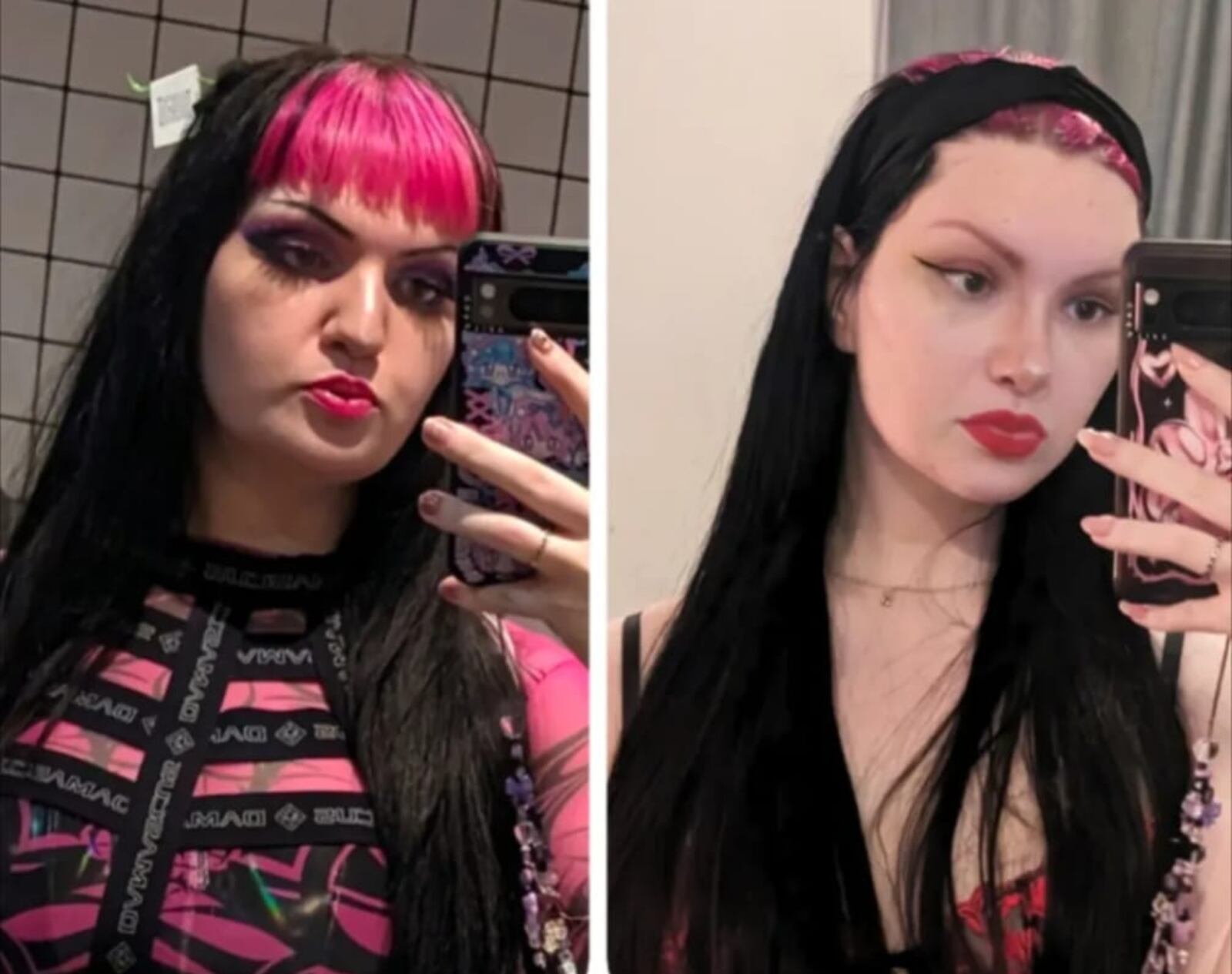 A before-and-after of the subject. Winter had a total of ten cosmetic surgeries to fix her body dysmorphia.