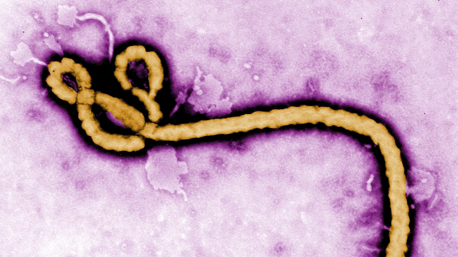 cheats/2014/12/29/scotland-confirms-ebola-case/141229-scotland-ebola-cheat_vaazxx