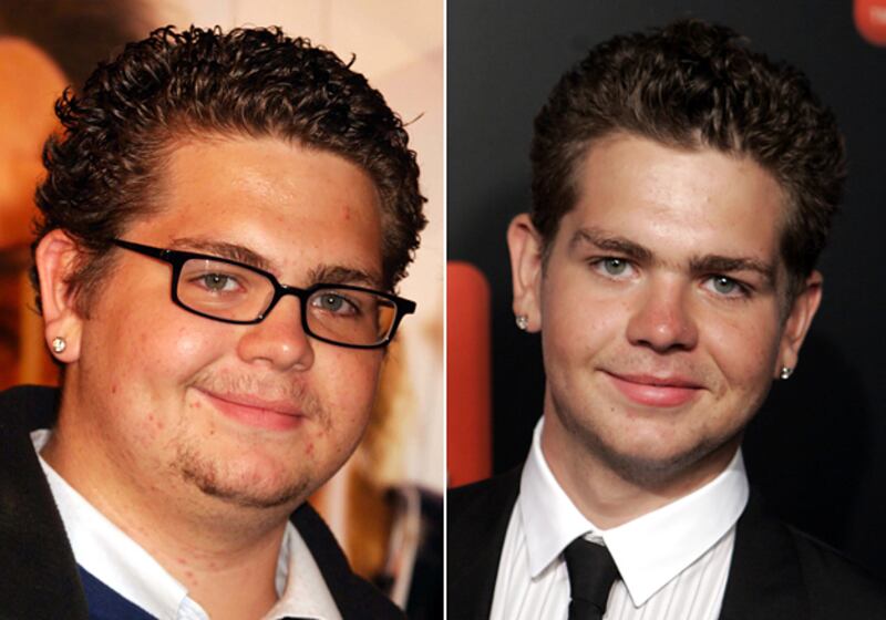 galleries/2009/04/09/schlub-to-chic/schlub-to-chic---jack-osbourne_zrnaey