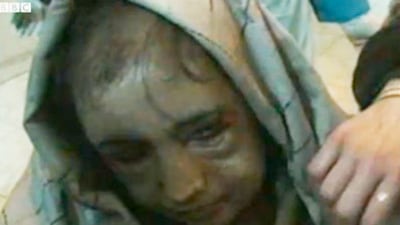 cheats/2011/12/29/afghan-girl-tortured-by-husband/afghanistan-girl-abused-cheat_xpqpum