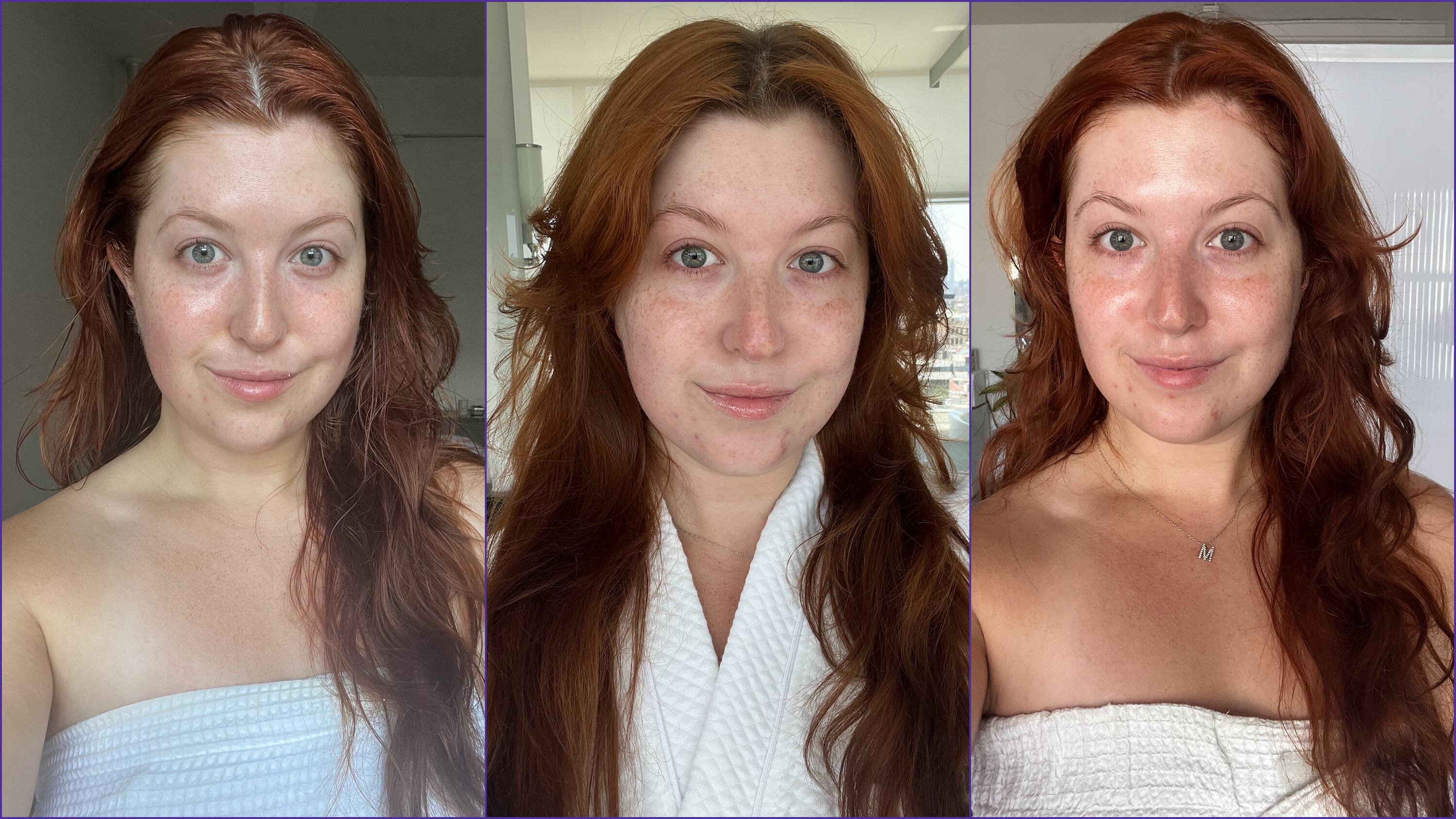 Writer Mary Honkus testing three types of facial treatments