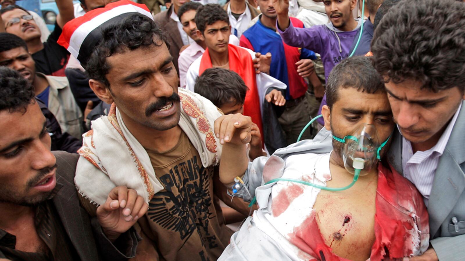 cheats/2011/06/01/battle-rages-in-yemenrsquos-capital/yemen-sana-battles_rgzucu