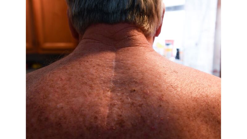 210806-KHN-implants-embed-04_ikbsj8