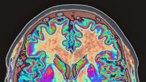 cheats/2011/06/01/woman-suffers-foreign-accent-syndrome/brain_mneyqy