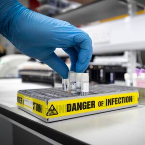 Clinical support technician Douglas Condie extracts viruses from swab samples so that the genetic structure of a virus can be analysed and identified in the coronavirus testing laboratory at Glasgow Royal Infirmary in Scotland.