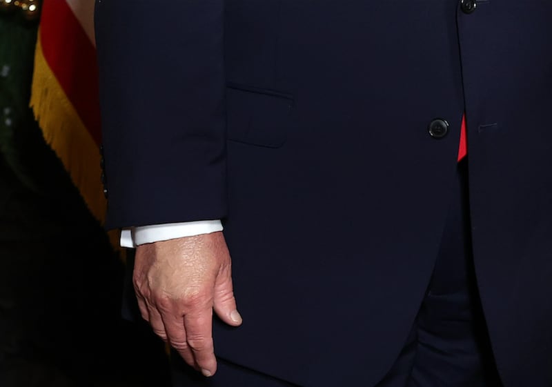 Close up of President Trump's hand make-up on December 22.