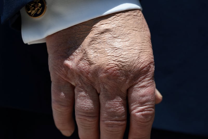 donald trump hand