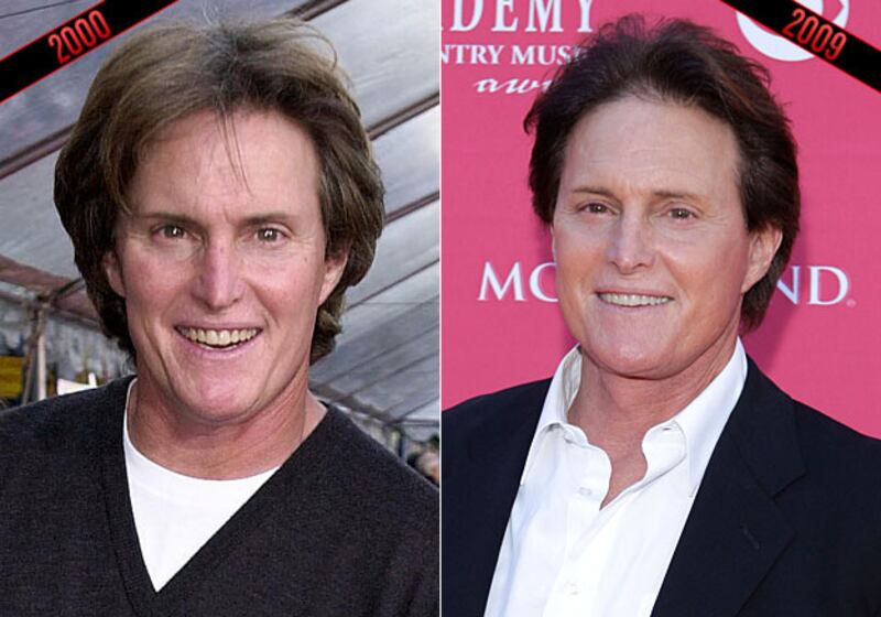 galleries/2009/12/07/ageless-celebs/ageless-celebrenner_mgibmp