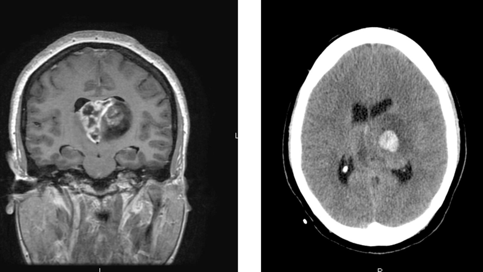 2017-07-20T214838Z_488846854_RC11176340C0_RTRMADP_3_USA-JOHNMCCAIN-GLIOBLASTOMA_qcfhh9
