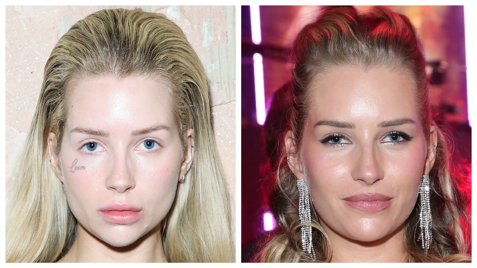 Lottie Moss's "Lover" tattoo in February 2024; Lottie Moss without her "Lover" tattoo in February 2026.