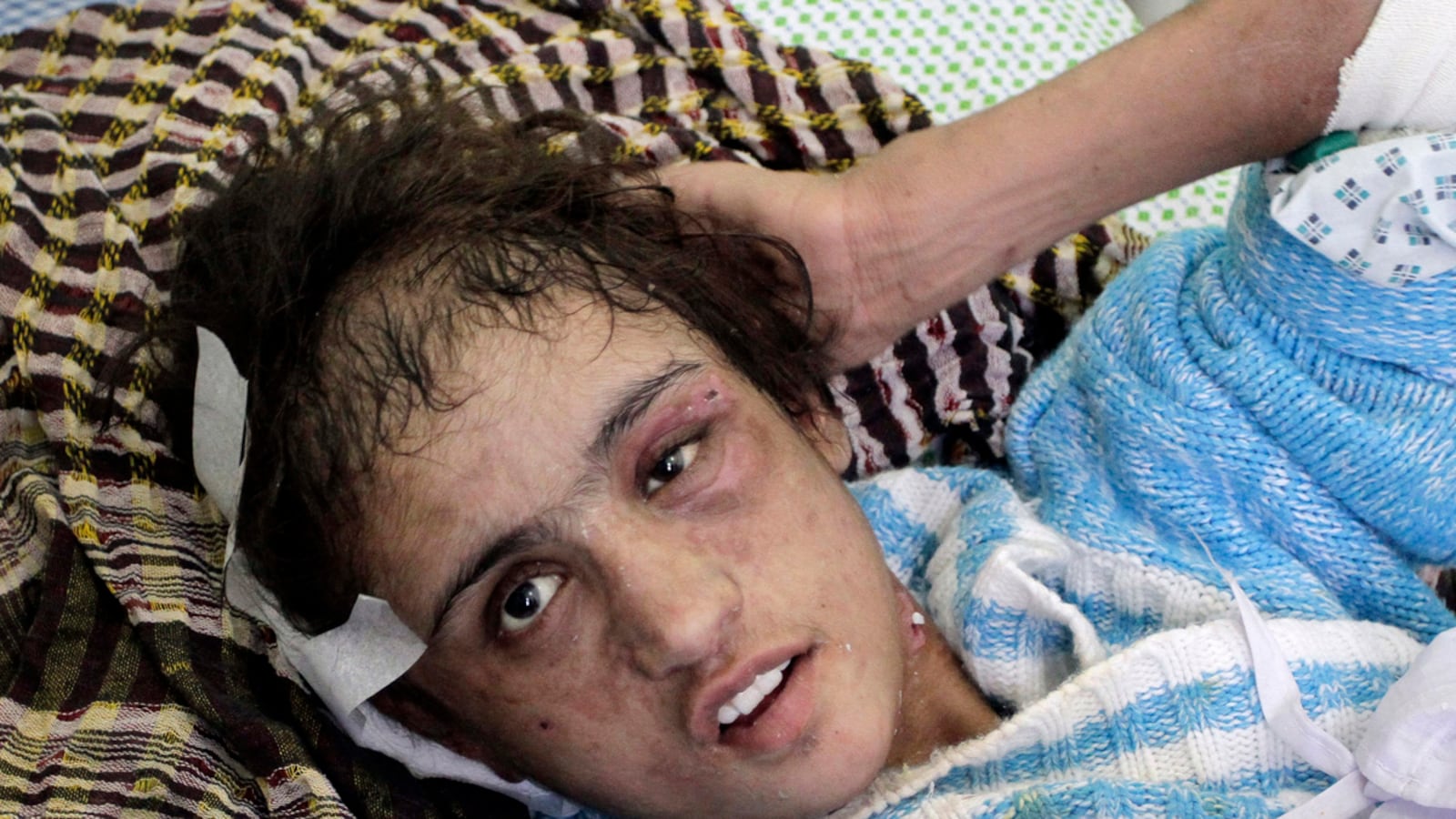 articles/2012/01/09/sahar-gul-torture-case-shows-limited-rights-perilous-lives-of-afghan-women/tortured-afghani-girl-lemmon_k2pbwm