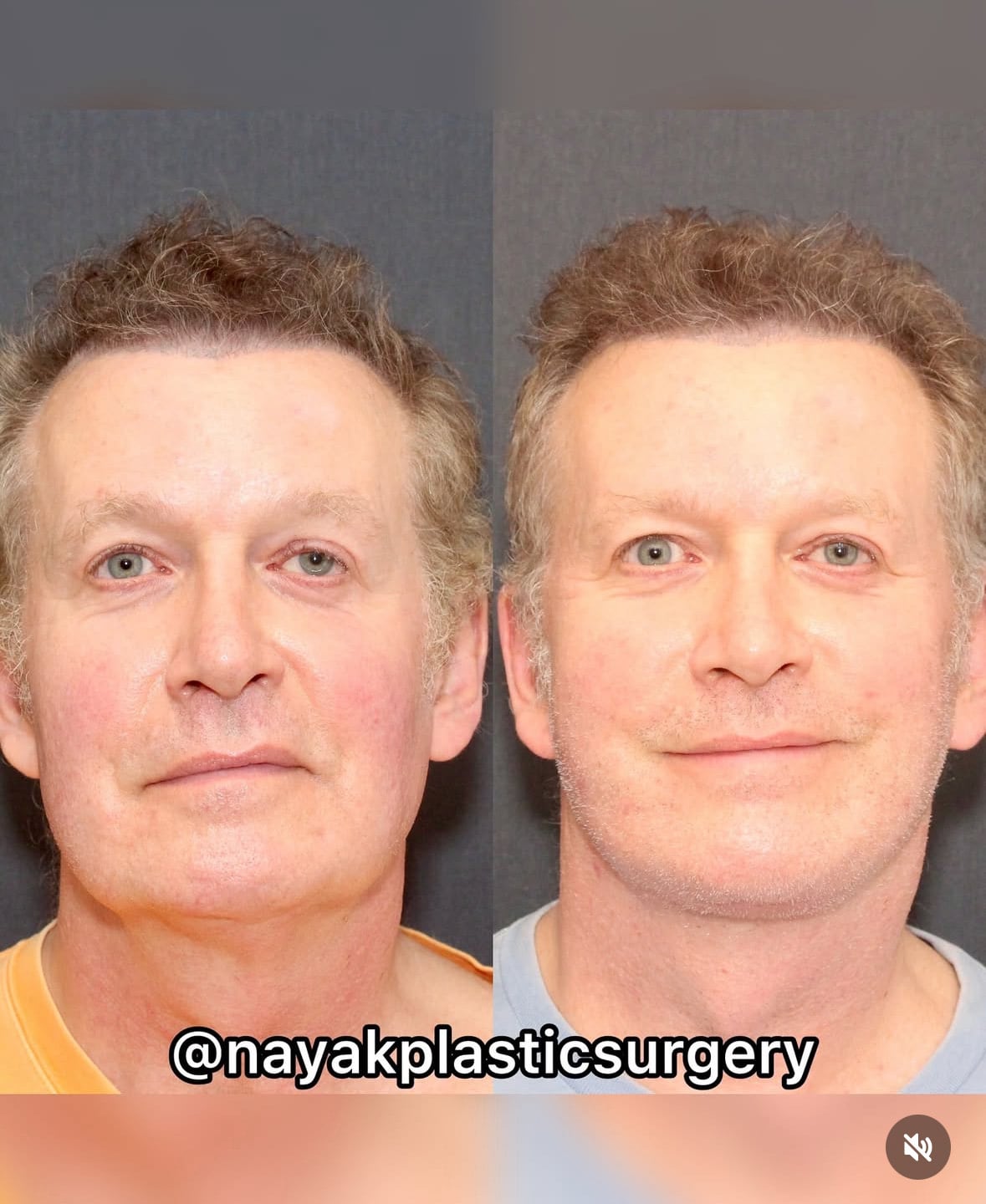Before-and-after photos of John Spaedy.