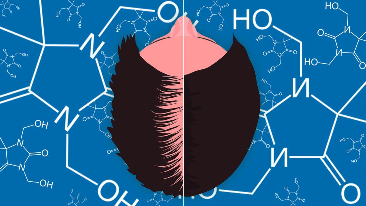 210713-Demopoulos-shampoo-hair-loss-tease_e1bhyz