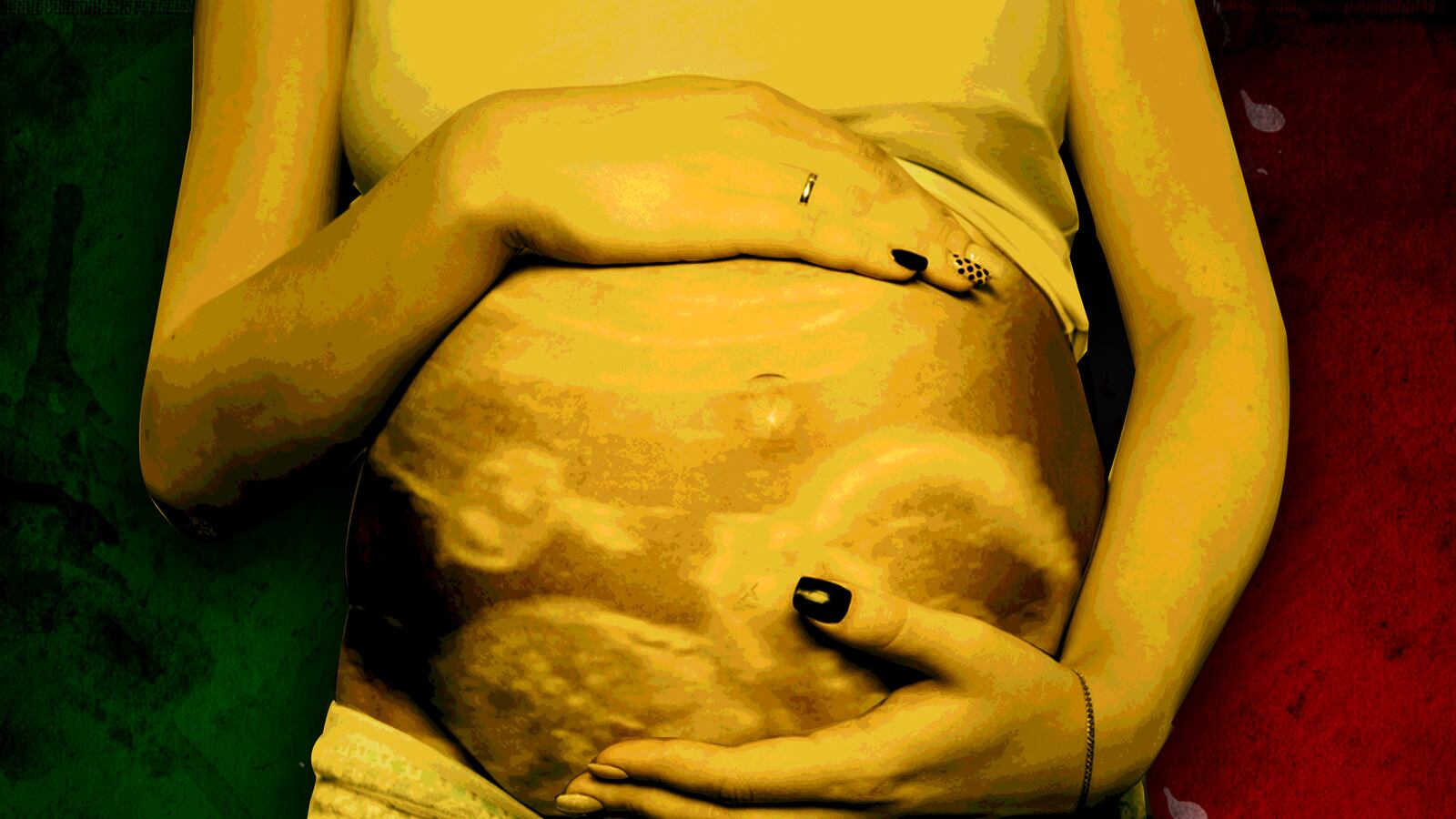 articles/2017/03/06/italy-needs-abortion-doctors/170307-Italy-doctors-abortions-tease_jufvxf