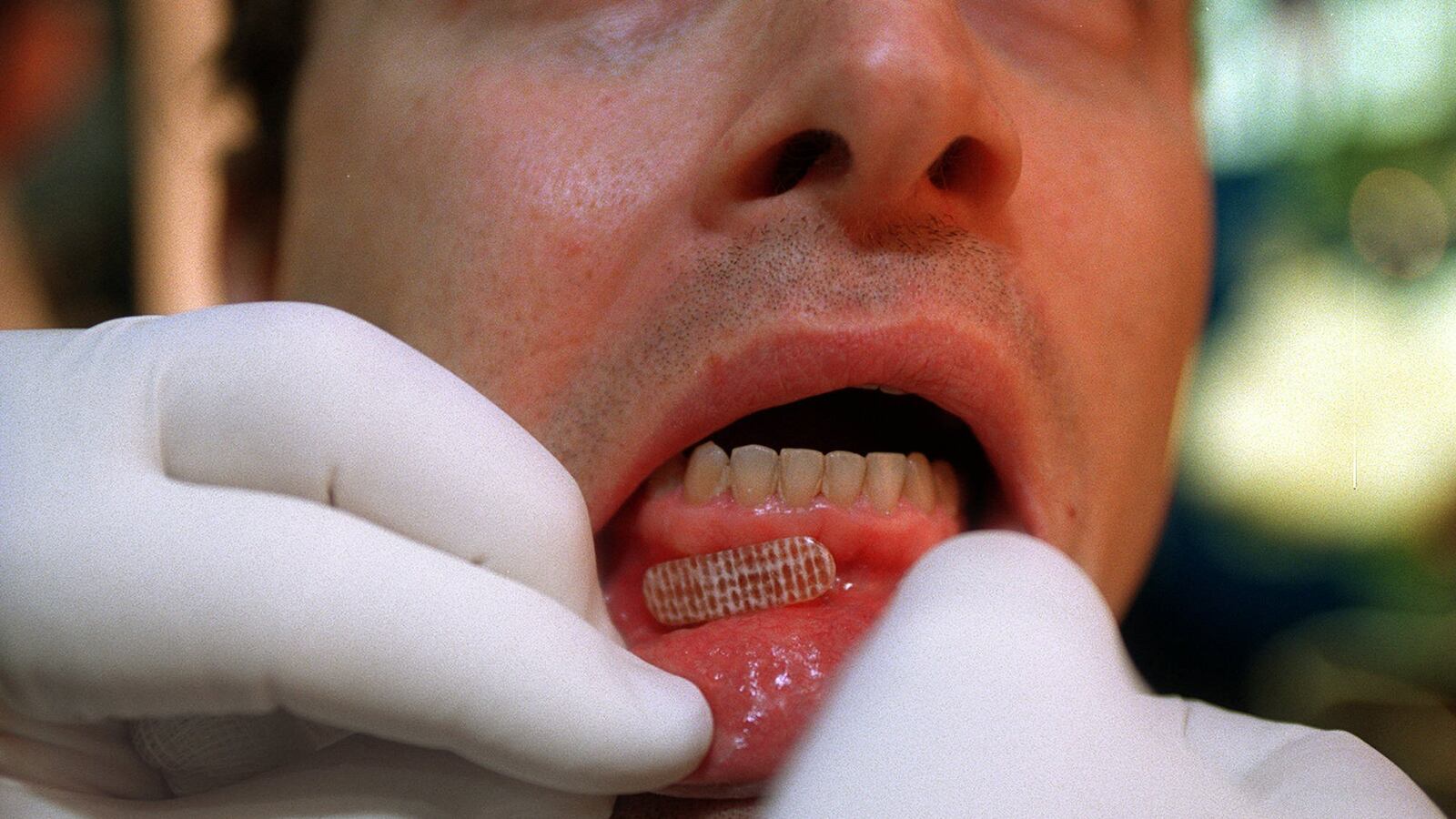 cheats/2013/03/28/7-000-dental-patients-need-hiv-testing/130328-dentist-cheat_e0kbob