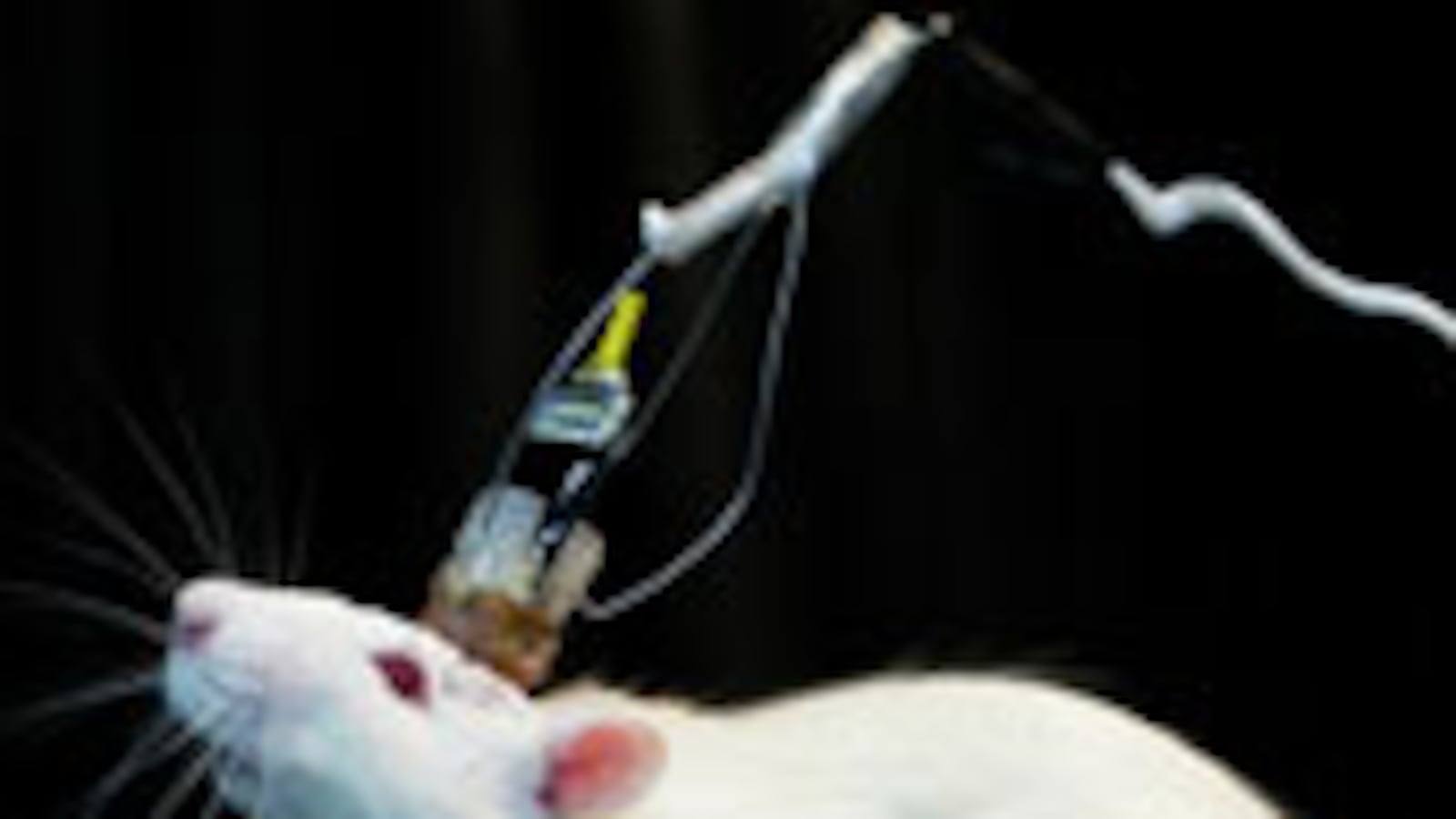 articles/2009/12/10/unlocking-alzheimers/seligson-alzheimers_68658_qgu8ce