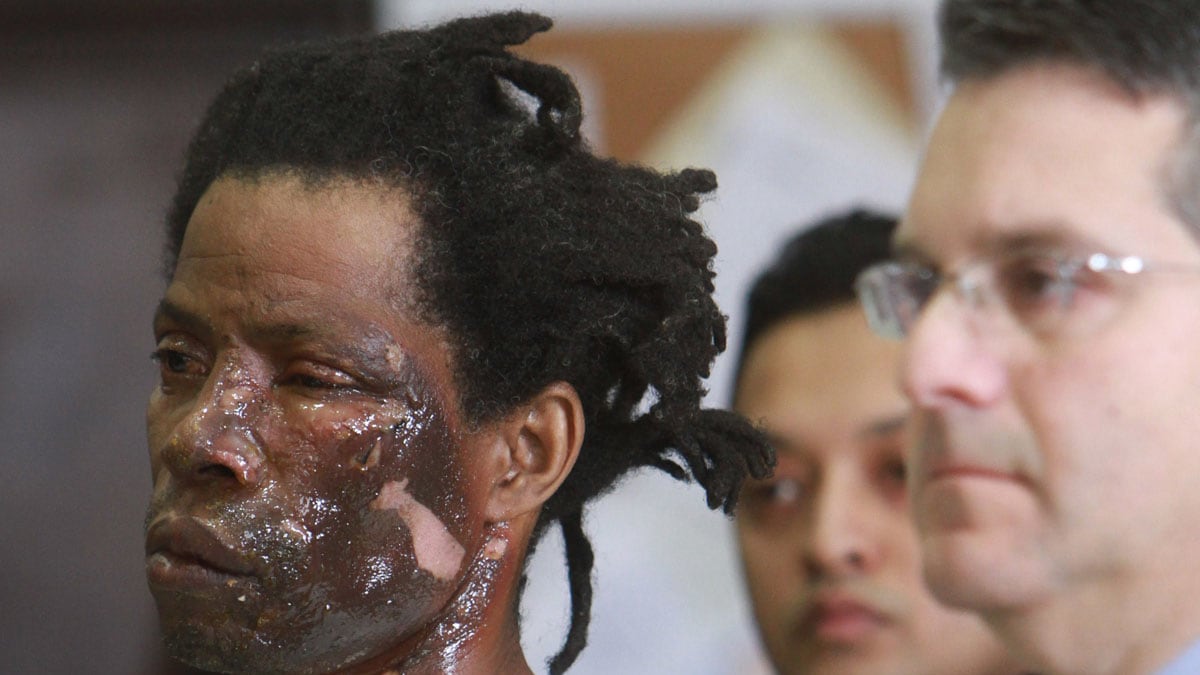 cheats/2011/12/20/elevator-suspect-s-face-badly-burned/jerome-isaac-elevator-fire-attacker-cheat_tpq31a