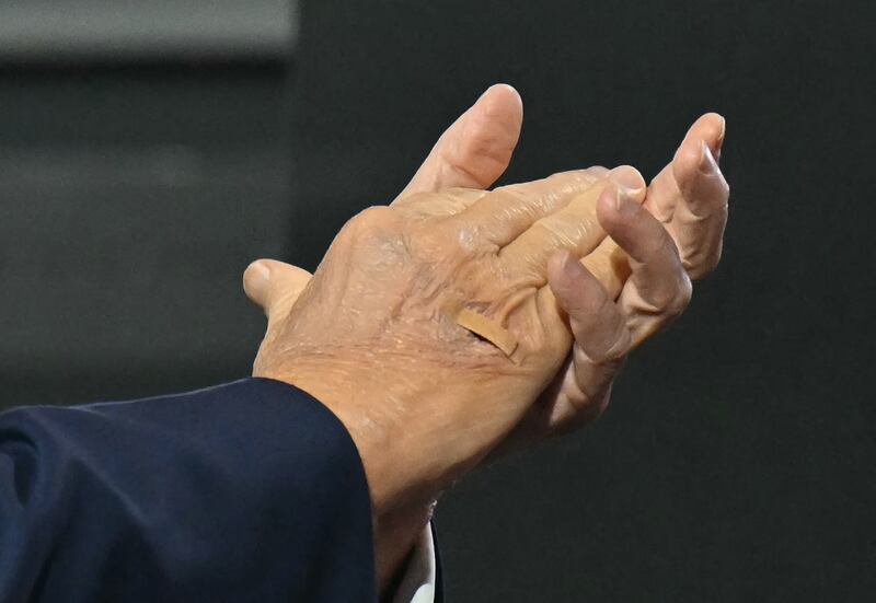 US former President and 2024 Republican presidential candidate Donald Trump (detail band-aid) applauds as he arrives for the second day of the 2024 Republican National Convention at the Fiserv Forum in Milwaukee, Wisconsin, July 16, 2024. Days after he survived an assassination attempt Donald Trump won formal nomination as the Republican presidential candidate and picked right-wing loyalist J.D. Vance for running mate, kicking off a triumphalist party convention in the wake of last weekend's failed assassination attempt.