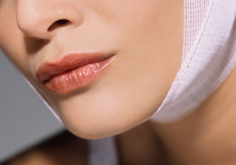 galleries/2010/11/27/cosmetic-procedures/cosmetic-procedures---trampoline-necklift_unlpnd