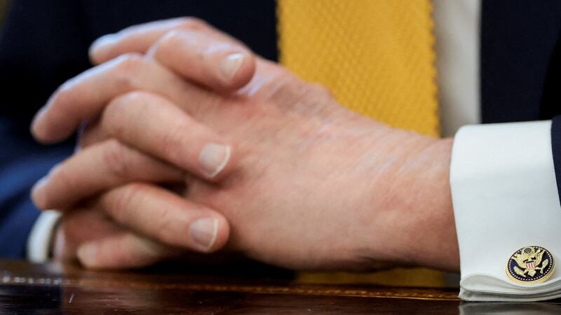 Donald Trump hands bruise