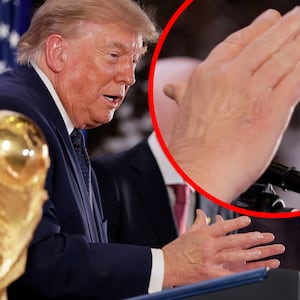 A close-up of Donald Trump's hand.