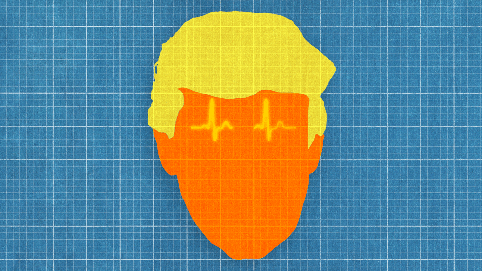 Donald Trump's head made of graph paper with his eyebrows as a heartbeat line