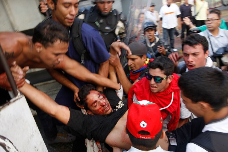galleries/2014/02/14/venezuela-erupts-in-violence-photos/venezeula-gal-9_irpduj