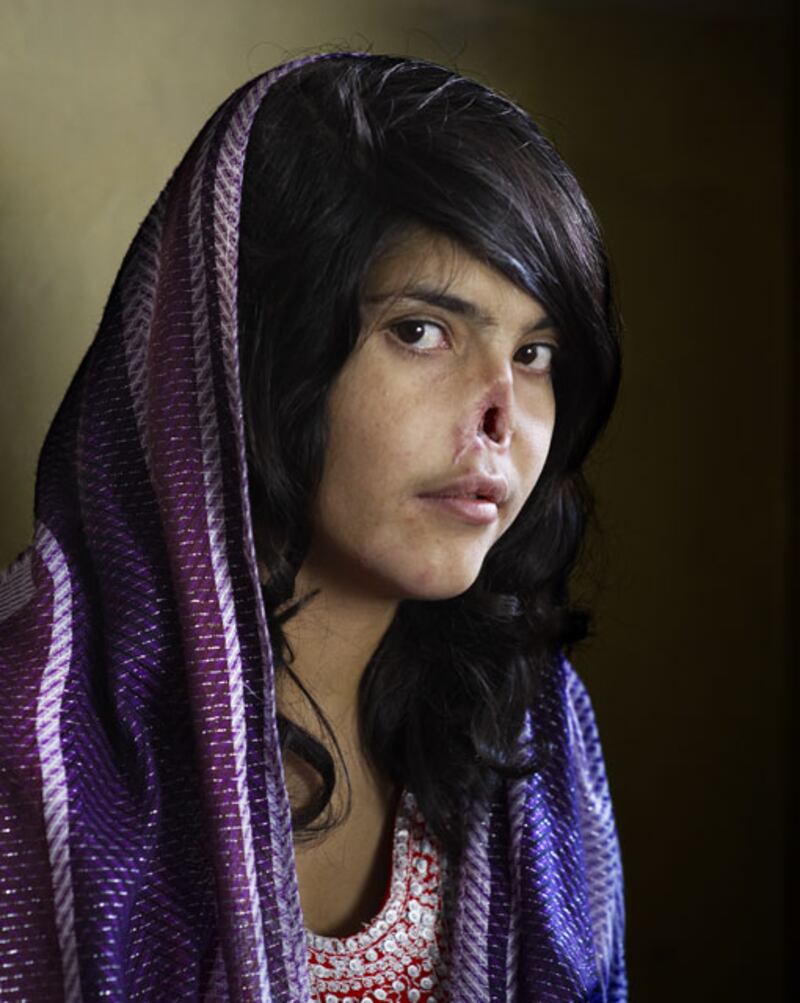 galleries/2011/02/11/world-press-photo-awards/world-press---jodie-bieber_vksyaj