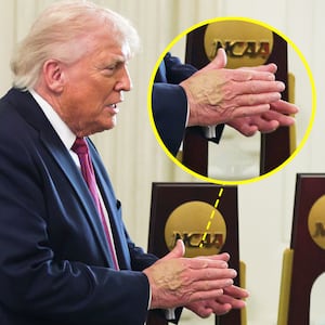 Donald Trump with makeup covering his bruised hand on April 21, 2026.