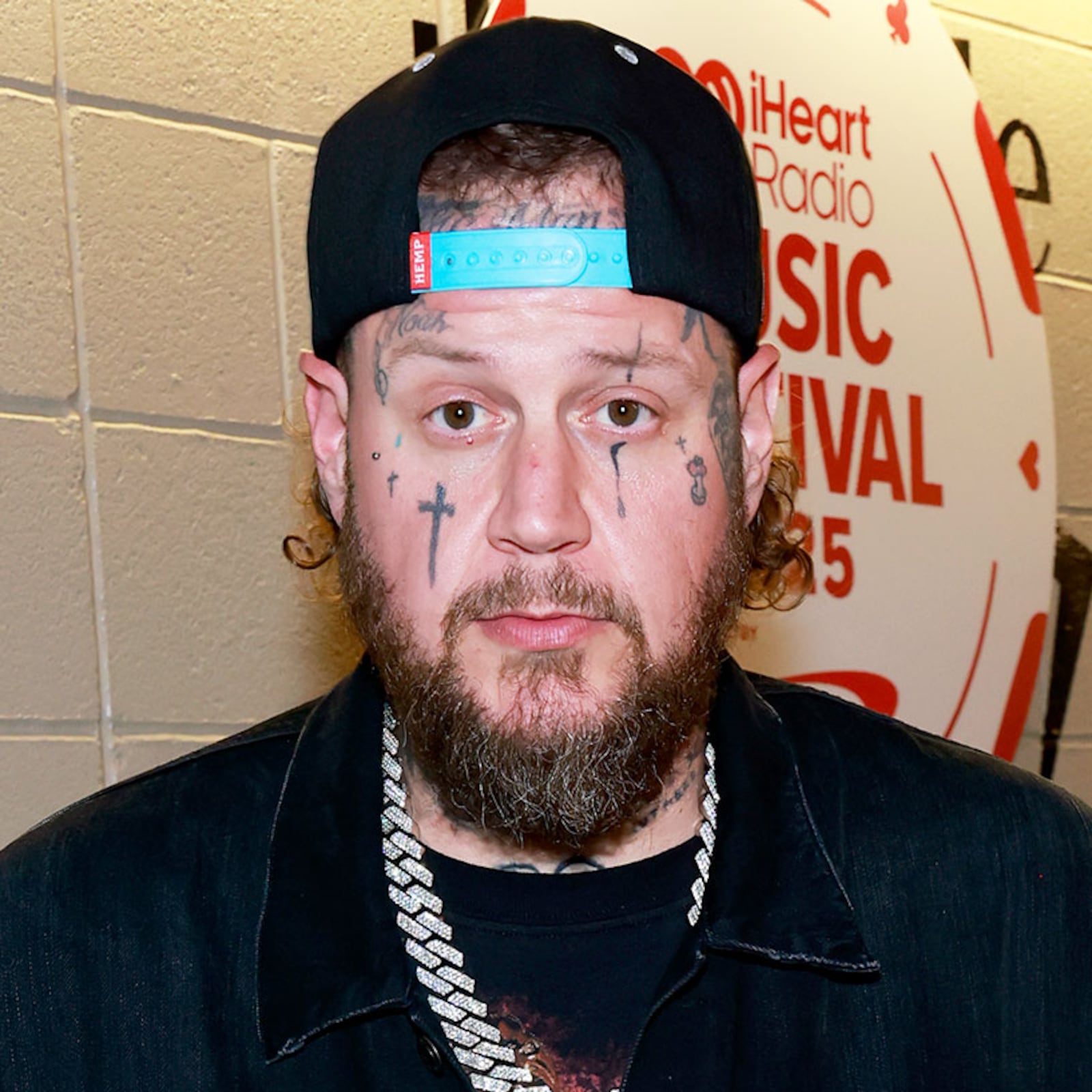 Jelly Roll before and after extreme weight loss