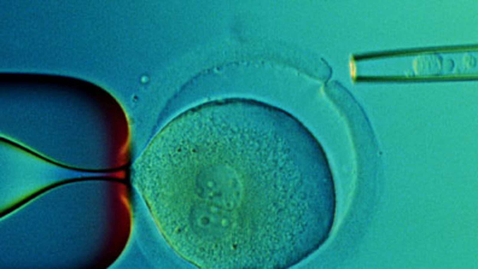 cheats/2009/03/09/obama-oks-stem-cell-funding/stem-cell_kqwe4m
