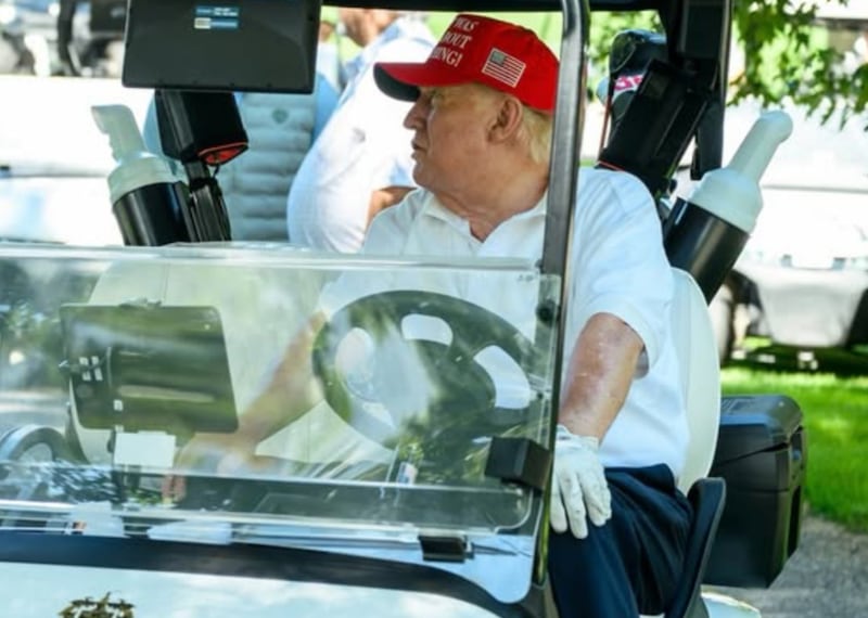 Trump's arm appeared to be bruised.