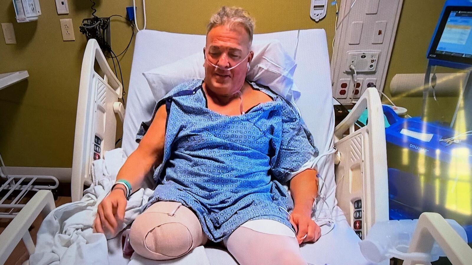 Buff Bagwell underwent a leg amputation following a car crash in 2020