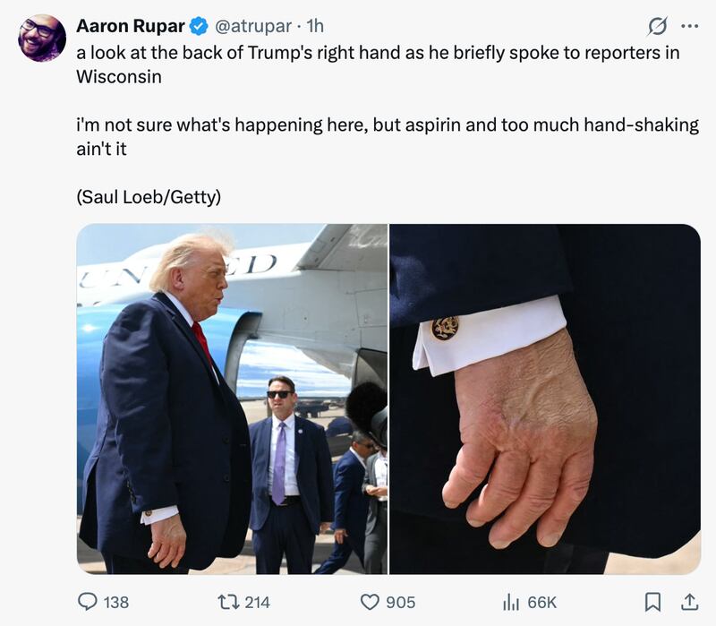 Ouch.