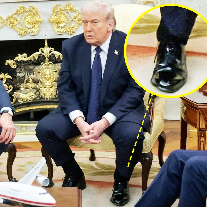 The cankles of President Donald Trump in the Oval Office, during his meeting with German Chancellor Friedrich Merz.