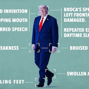 Donald Trump's many medical issues.