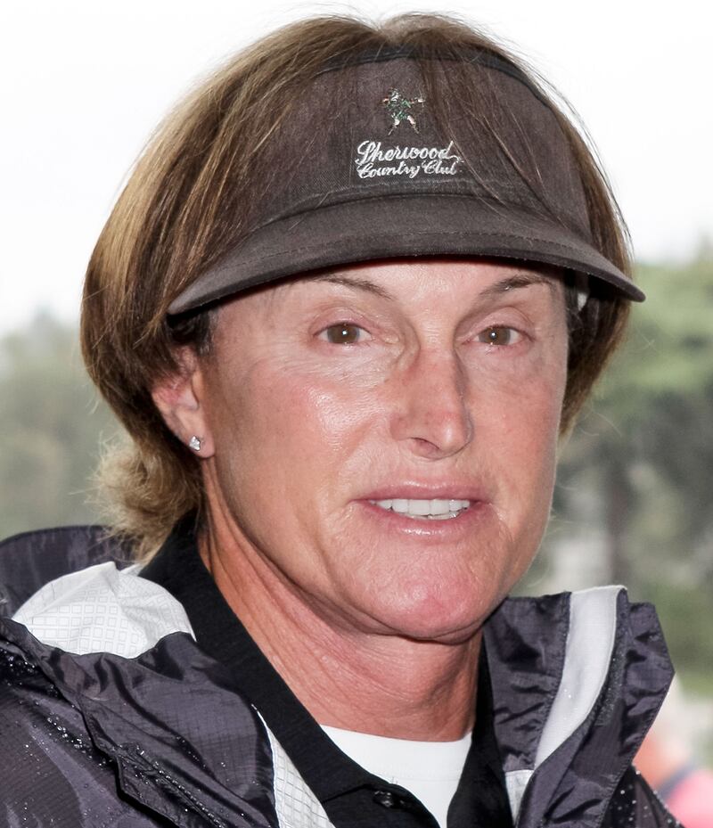 galleries/2013/06/26/amanda-bynes-courtney-stodden-more-celeb-plastic-surgeries-photos/130625-bruce-surgery-gallery_alprs3