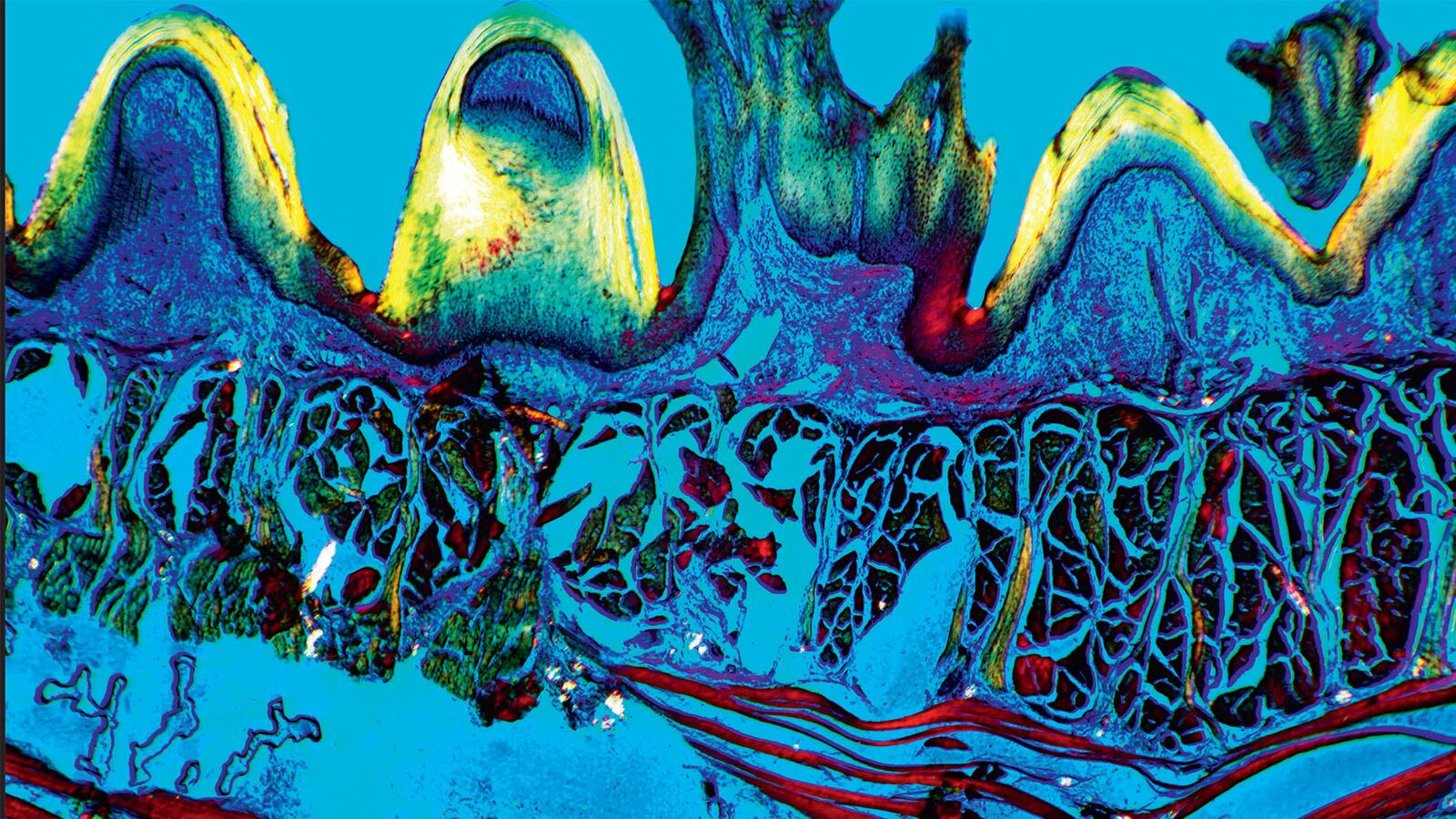 galleries/2015/02/02/a-way-too-close-look-at-the-human-body/150130-science-beautiful-tongue-tissue_vqqe3z