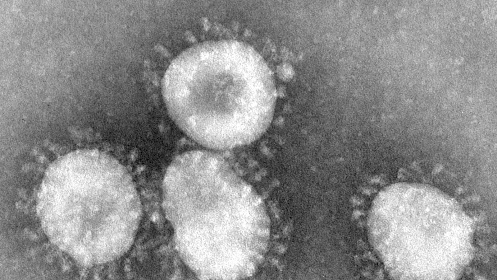 cheats/2012/09/24/new-sars-like-virus-detected/sars-virus-cheat_p5snax