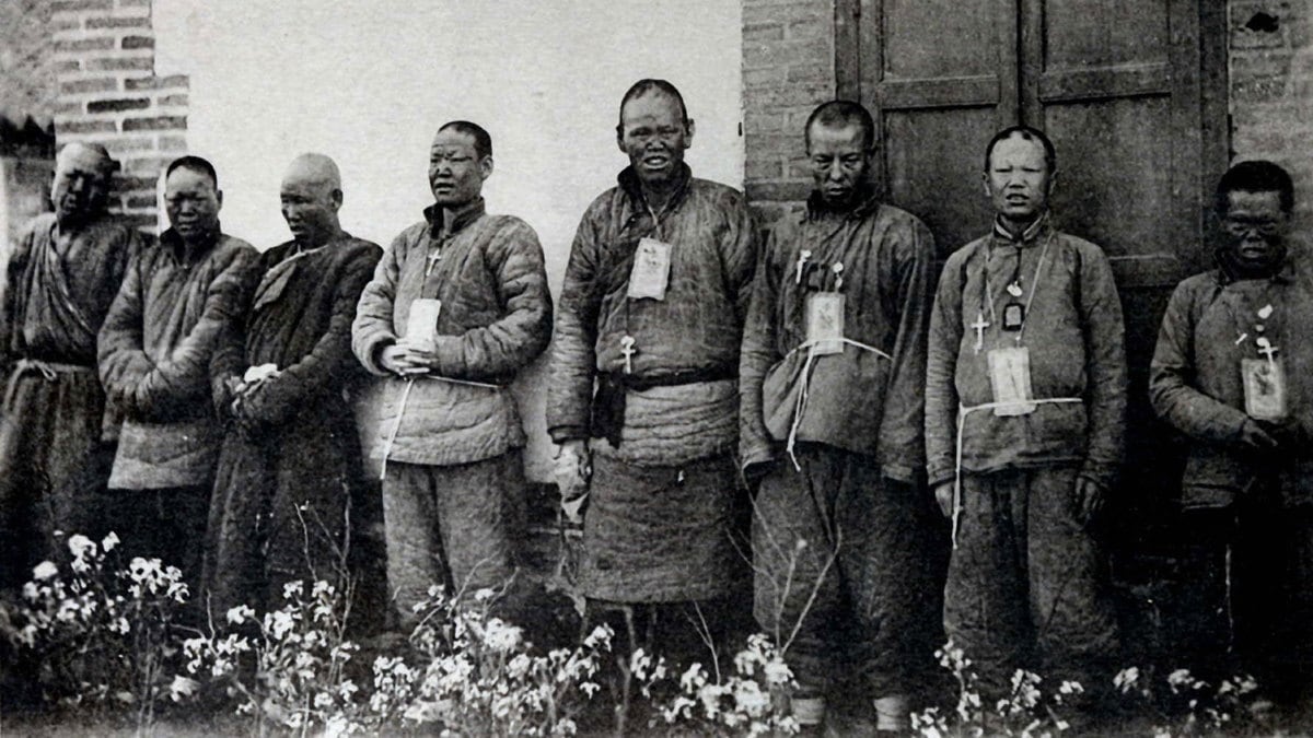 200726-leprosy-xenophobia-hero_tvmpan