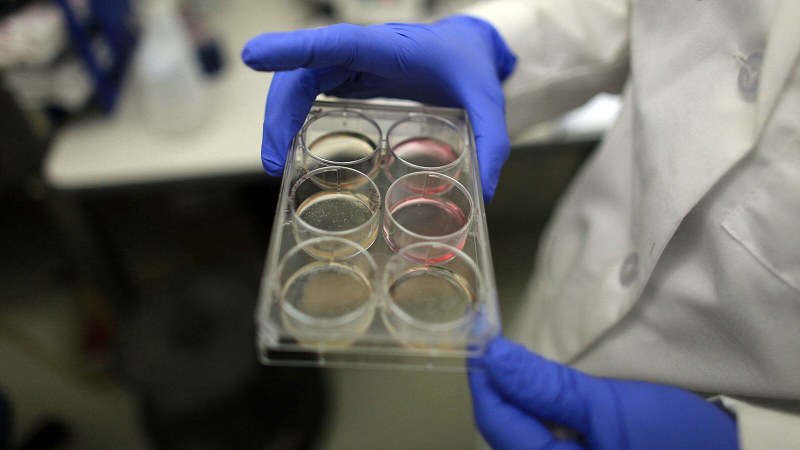 GettyImages-103686416_1_1_k4dga7