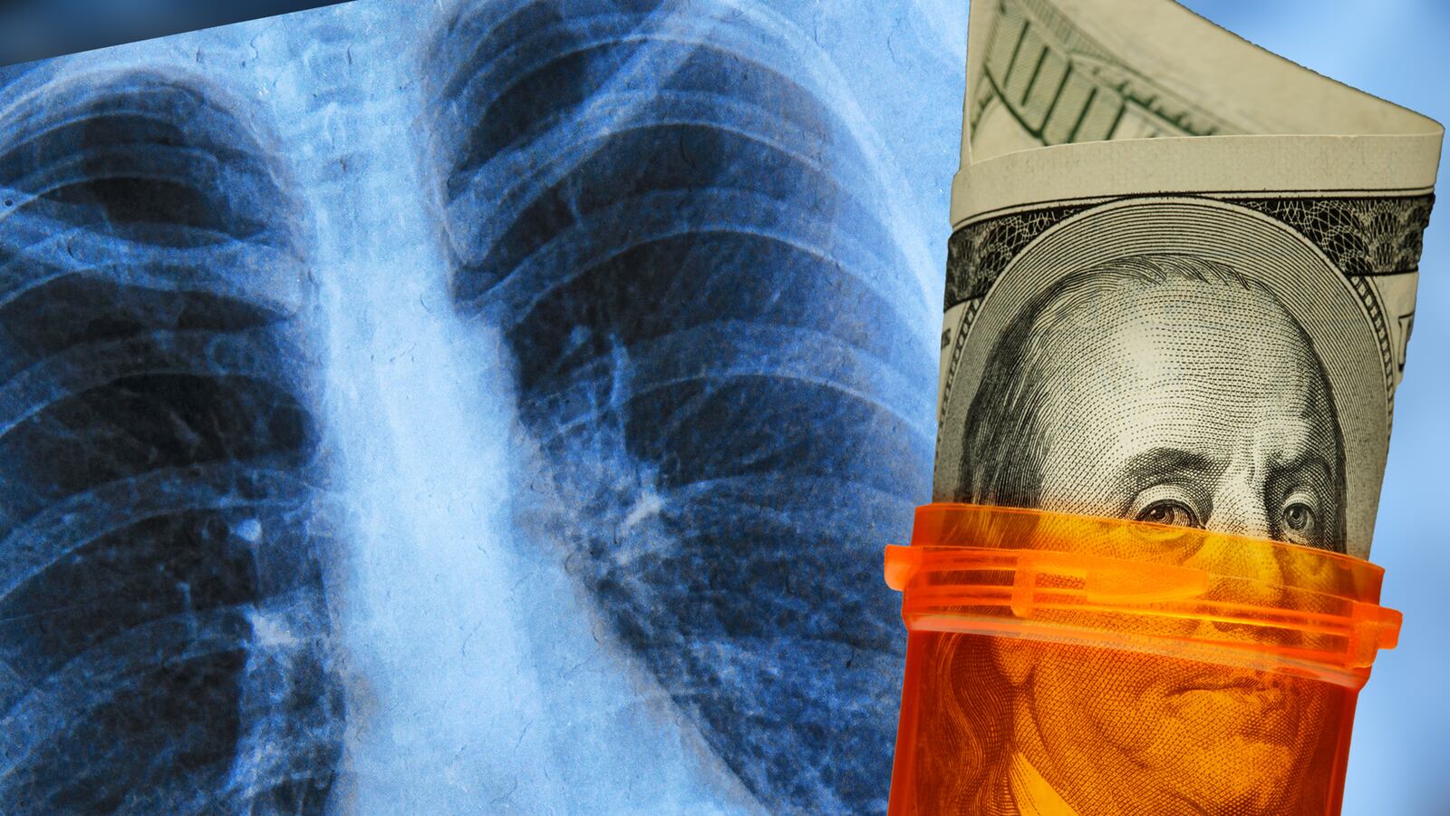 articles/2017/03/24/how-trumpcare-will-kill-me-before-cystic-fibrosis-can/170324-Cathcart-CF_tease_q6vp6q