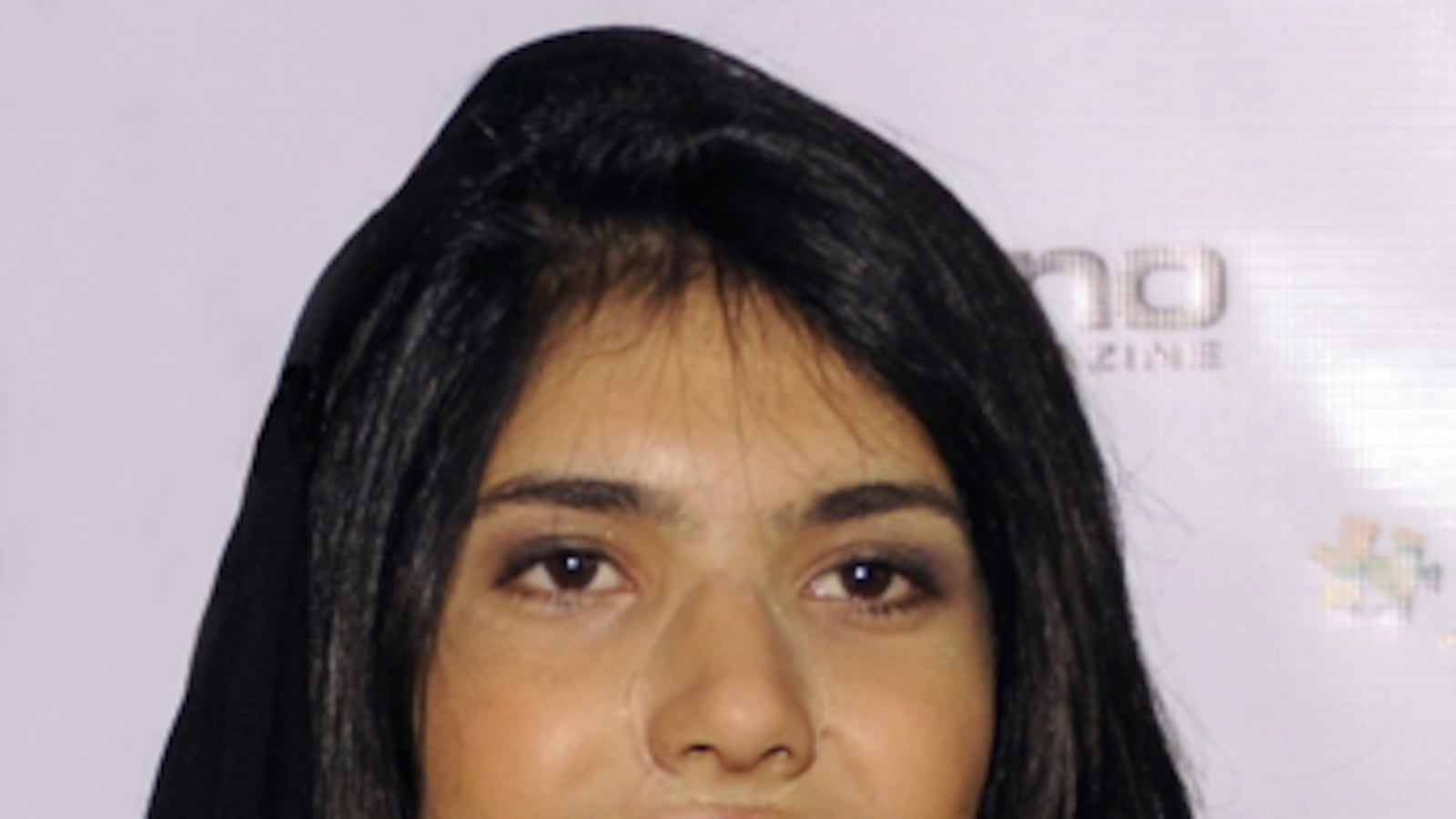 articles/2010/11/21/bibi-aishas-pain-isnt-over-tragic-afghan-story-one-year-on/lemmon-bibi_mmsnwe