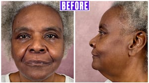 For The Looker - This Surgeon Gave His Mother a Facelift and the Results Went Viral