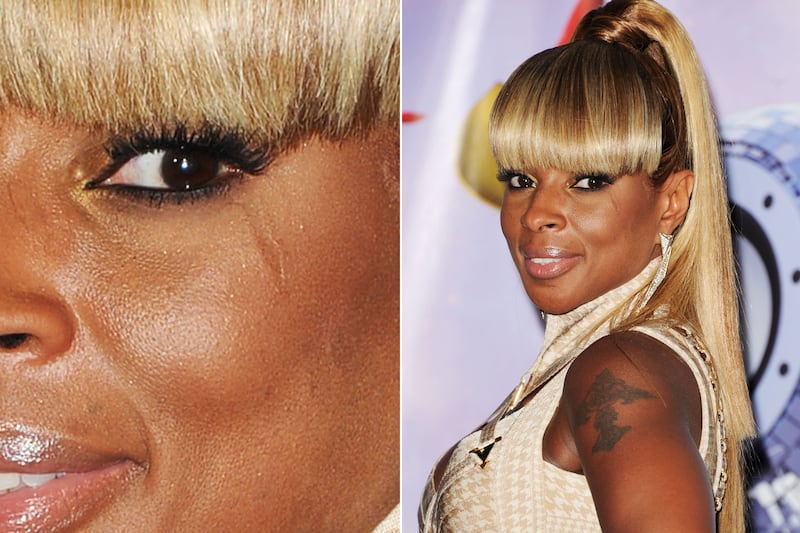 galleries/2011/12/01/kate-middleton-and-other-stars-with-scars-photos/stars-scars-blige_fta9kh