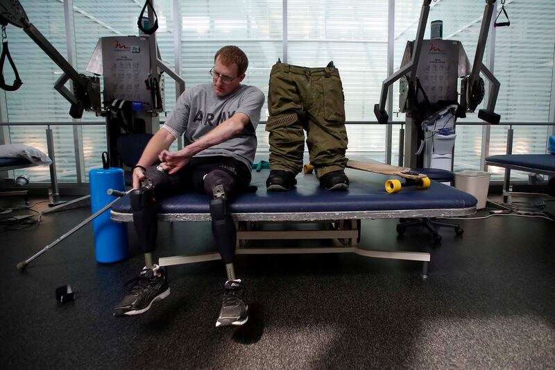 galleries/2014/08/02/the-road-home-from-an-ied-to-idaho-photos/140801-wounded-soldier-7_qm8bxj